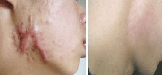 ?？谑姓吾t(yī)院哪家好？專家推薦最具口碑的?？谡吾t(yī)院有哪些？