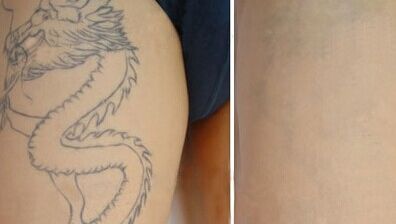 南京哪家醫(yī)院做面部提升效果最好？