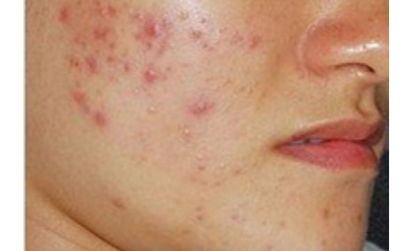 想了解寧波慈溪圣愛醫(yī)院醫(yī)療美容整形科價格表？醫(yī)生口碑如何？