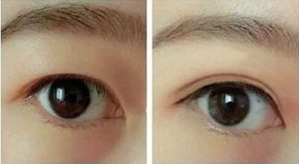 合肥哪家整形醫(yī)院好口碑好服務(wù)好值得推薦？