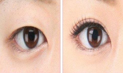 南昌市哪家醫(yī)院去痘好？專家推薦的南昌市治療痘痘的一流醫(yī)院有哪些