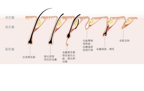 深圳哪家激光祛斑醫(yī)院口碑好？