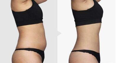 西安華仁醫(yī)院怎樣通過馬世理改臉型技術(shù)，成功改善面部輪廓？