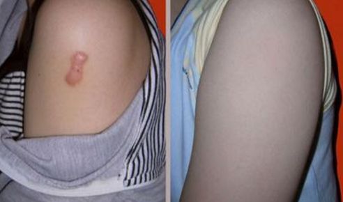 西安市哪家醫(yī)院整容效果好，值得信賴？