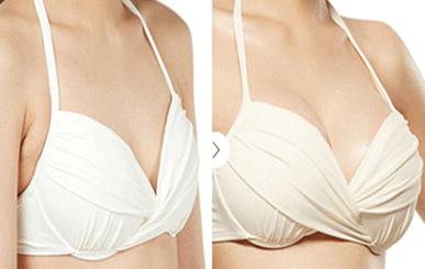 2023南京線雕去魚(yú)尾紋權(quán)威醫(yī)生排行榜前10位(楊苓山、劉寧、朱臺(tái)航價(jià)格便宜又實(shí)用)