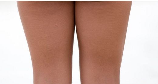 成都哪家醫(yī)院做眼袋好，治療眼袋效果明顯的醫(yī)院有哪些