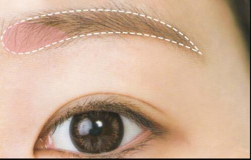 醫(yī)生的隆胸技術(shù)如何？成都網(wǎng)紅整形醫(yī)生實(shí)力評估及價(jià)格參考！