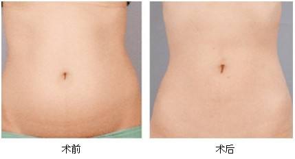 2023湘潭彩光美白嫩膚專家前10位排行榜(劉佑文、熊宜文、熊志能幫你圓夢(mèng))