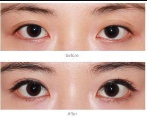 鄭州整容醫(yī)院哪家好？教你如何選擇適合自己的整容醫(yī)院