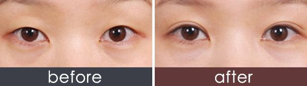 西安哪家美容醫(yī)院口碑好，專業(yè)評測推薦？