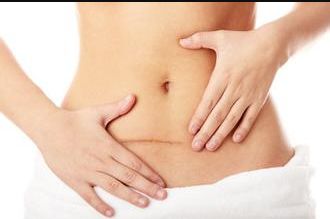 遼陽豐胸整形醫(yī)院哪家好？挑選醫(yī)院應(yīng)注意哪些關(guān)鍵點(diǎn)？