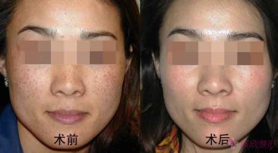 2023廈門(mén)生長(zhǎng)紋射頻祛除醫(yī)生前10位上榜清單(王雪春、陳麗平、易朝華在榜內(nèi))