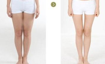 貴州整容醫(yī)院哪家好？權(quán)威專家為您推薦