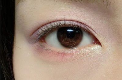 王世虎拉皮和脂肪填充的效果如何？有哪些多樣化的項(xiàng)目值得選擇？技術(shù)是否可靠可證？