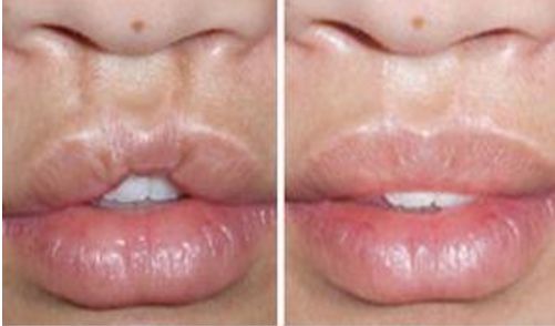 鞍山哪家醫(yī)院做手術(shù)除皺好