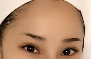 上海醫(yī)院最好治療皮膚疤痕的專科是哪家？