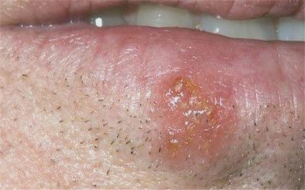 2023新疆水光針祛除唇紋醫(yī)生排行榜前十強(qiáng)(張傳功、李朝陽(yáng)、張偉詳細(xì)資料)