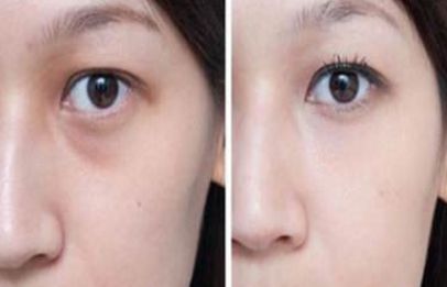 上海整形私密醫(yī)院排名及口碑，哪家好？