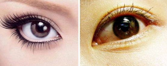 安徽省哪家醫(yī)院割雙眼皮效果最好，技術(shù)最先進(jìn)，口碑最好？