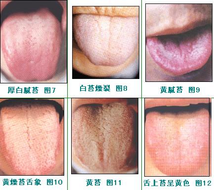 2023株洲眼紋微創(chuàng)提升排名榜top10專家(謝磊、張臘林、陳守正強(qiáng)烈來襲)