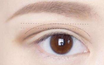 2023昆明眼睛細(xì)紋凹陷填充專家前10位上榜清單(黃柴永、劉瑋、崔亞萍值得選擇！)