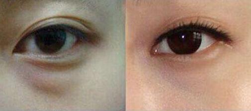 上海更受推薦的隆胸專家排行榜！王濤、江華等5位魅力無限，非?？孔V！