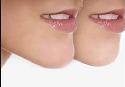 上海除疤痕哪家醫(yī)院好？選擇這家專業(yè)醫(yī)院，讓你告別疤痕煩惱！