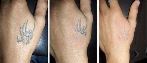 商丘市整容醫(yī)院哪家好？綜合評價一覽，找到適合您的理想之選！