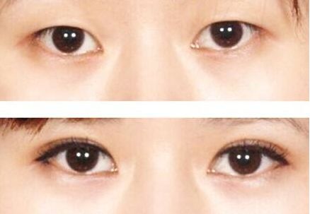 榆林市美容哪家醫(yī)院好？榆林市頂級美容醫(yī)院推薦