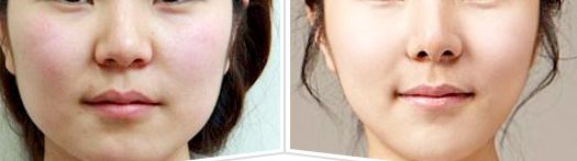 廣西哪家整形美容科醫(yī)院值得選擇？