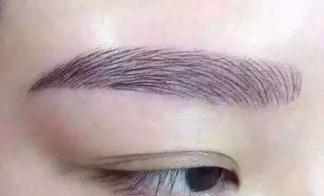 穆寶安拉皮術(shù)：北京抗衰行家評價及手術(shù)費(fèi)用、醫(yī)院選擇指南