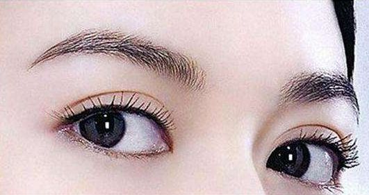 深圳哪家醫(yī)院的雙眼皮手術(shù)效果好？