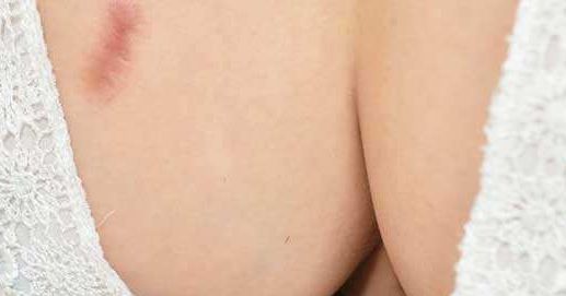 山東小陰唇手術(shù)哪家正規(guī)專業(yè)值得選擇？