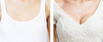 上海抽脂整形醫(yī)院排名2023：哪家好且性價(jià)比更高？