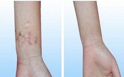 濟(jì)寧去雀斑醫(yī)院哪家好？揭秘濟(jì)寧市治療雀斑效果最好的醫(yī)院