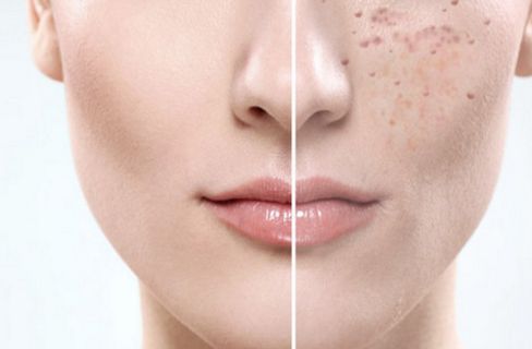 福建泉州海峽醫(yī)療美容醫(yī)院怎么樣？福建泉州海峽醫(yī)療美容醫(yī)院簡介|醫(yī)生團(tuán)隊|口碑評價！