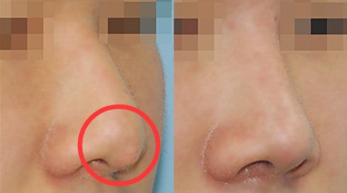 福州哪家醫(yī)院做疤痕好？比較全面的福州疤痕治療醫(yī)院推薦給您！