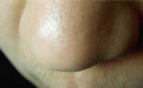 2023黃石后背吸脂權(quán)威專家口碑前10位(李小燕、施蕾、黃志鵬是上上之選！)