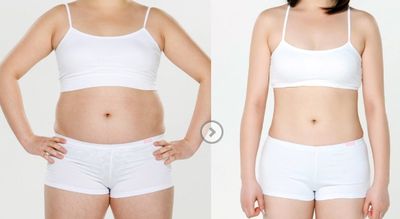 蘇州祛斑好醫(yī)院哪家好？專家推薦：蘇州效果好的祛斑醫(yī)院排行榜