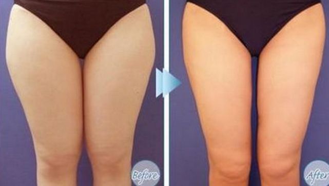 大連專業(yè)祛斑哪家醫(yī)院好？祛斑效果最好的醫(yī)院有哪些？