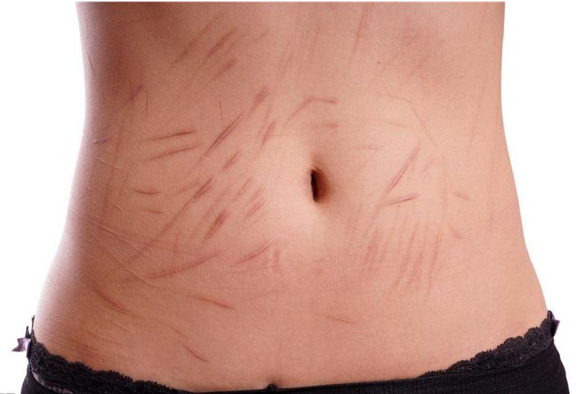 南京抽脂手術(shù)那家醫(yī)院技術(shù)靠譜？哪家醫(yī)院的抽脂效果好？