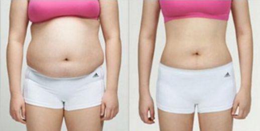 南昌哪家醫(yī)院的吸脂效果好？