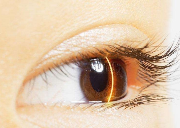 2023蕪湖小切口去額頭紋口碑排名top10強(qiáng)醫(yī)生(曹閃妹、劉傳、謝紀(jì)輝前三打頭陣！)