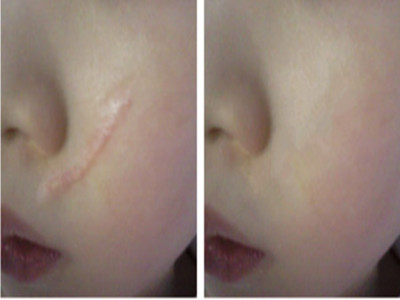 2023鄭州隆鼻線雕排名榜前10名的專家(王慧君、孔宇、李曉娟新版醫(yī)生名單上線)