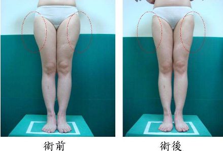 昆明哪家治痘痘好的醫(yī)院，痘痘問題如何有效解決？