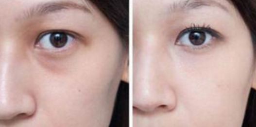 武漢看胎記醫(yī)院哪家好？綜合醫(yī)療機構(gòu)排行榜詳細解讀