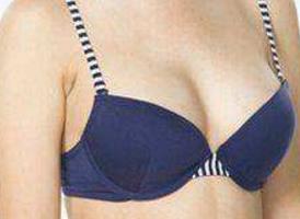 2023西安靜態(tài)紋填充脂肪醫(yī)生TOP10強(qiáng)(郭淑華、何天峰、王鵬在榜！)