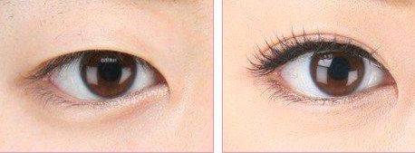 上海哪家醫(yī)院做處女膜修復(fù)好？