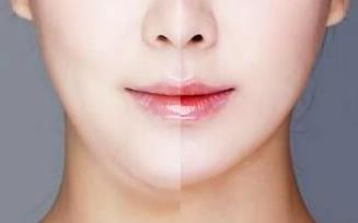 2023岳陽大腿吸脂修復(fù)正規(guī)醫(yī)生排行榜10強(qiáng)(歐陽燕萍、高景恒、楊淑云這幾個(gè)專家名氣都不錯(cuò)！)