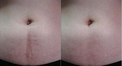 宜昌眼科醫(yī)院哪家好，專業(yè)眼科醫(yī)生助您解答